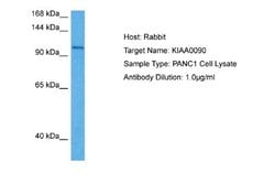 EMC1 Antibody, Novus Biologicals 100 &mu;L; Unconjugated:Antibodies, Polyclonal
